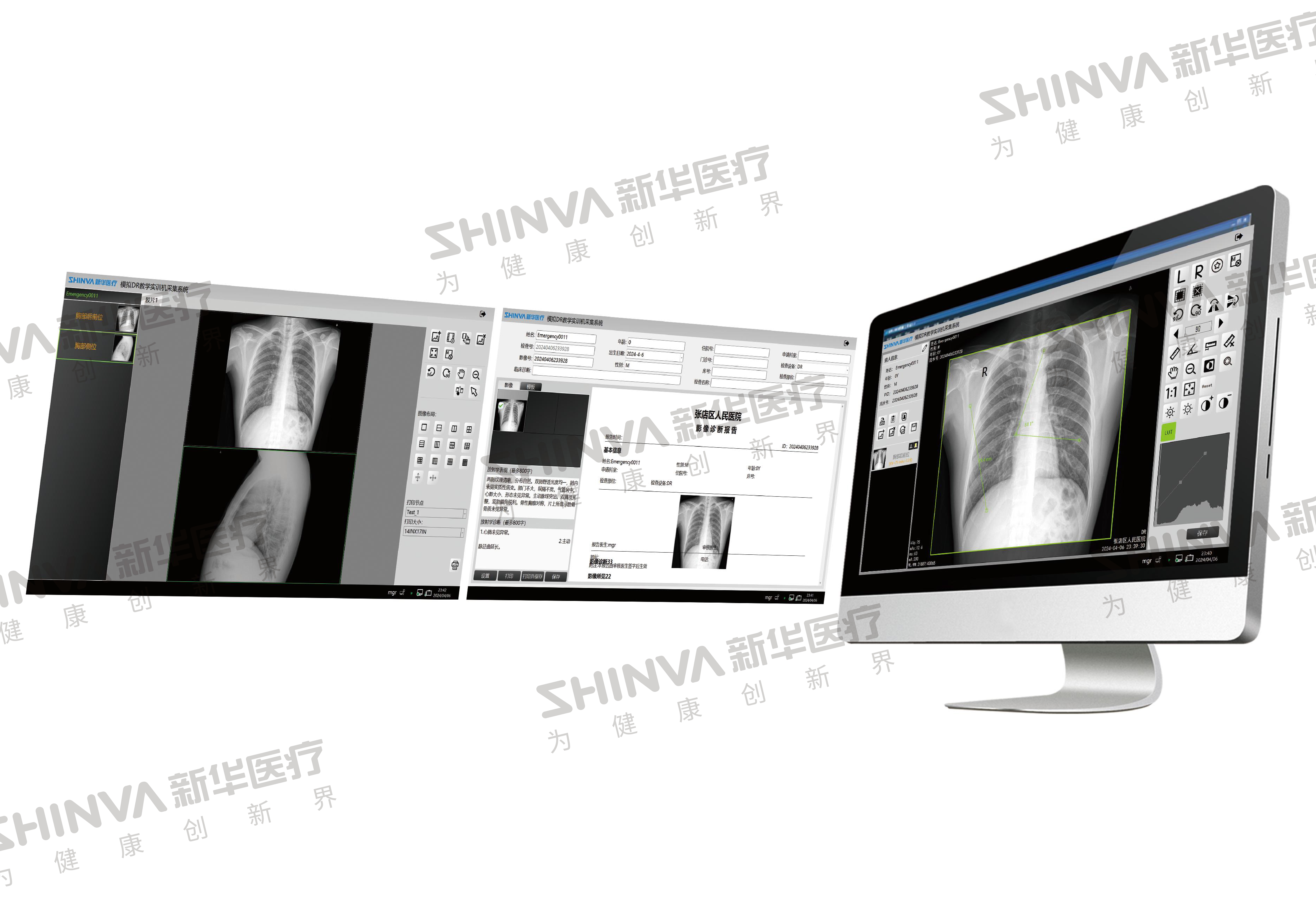 6智能化模拟DR教学实训机-DR图像采集采集及后处理工作站2.jpg